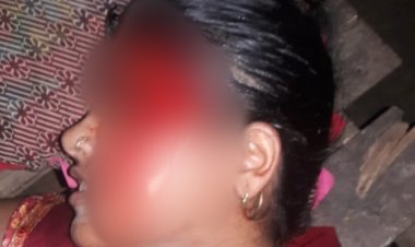 चचेरे देवर तथा ससुर ने युवती पर किया रड एवं फरसा से प्रहार,एफआईआर दर्ज