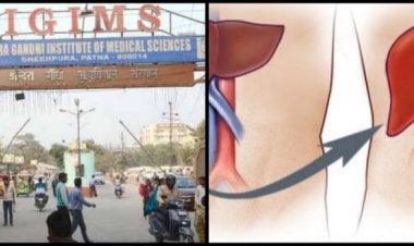 पटना : आइजीआइएमएस के डॉक्टरों की बड़ी उपलब्धि, लिवर ट्रांसप्लांट कर रचा इतिहास
