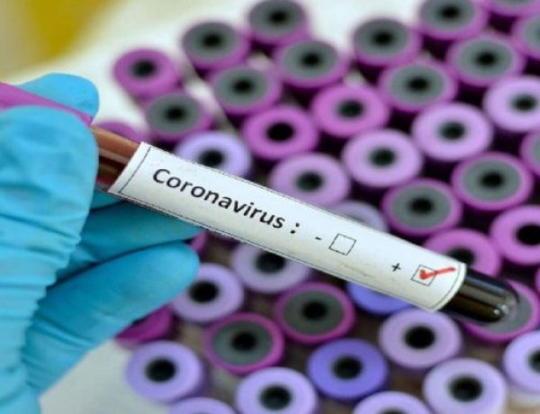 रामगढ़ में कोरोना ने दी दस्तक,2 मरीज कोरोना पॉजिटिव