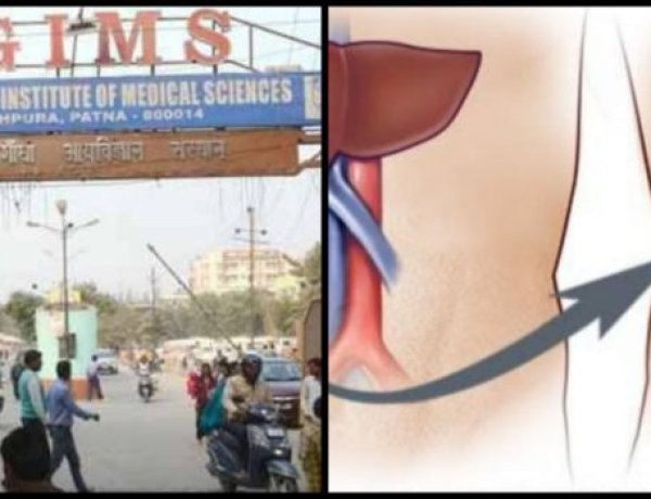 पटना : आइजीआइएमएस के डॉक्टरों की बड़ी उपलब्धि, लिवर ट्रांसप्लांट कर रचा इतिहास