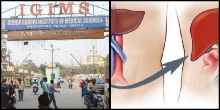 पटना : आइजीआइएमएस के डॉक्टरों की बड़ी उपलब्धि, लिवर ट्रांसप्लांट कर रचा इतिहास