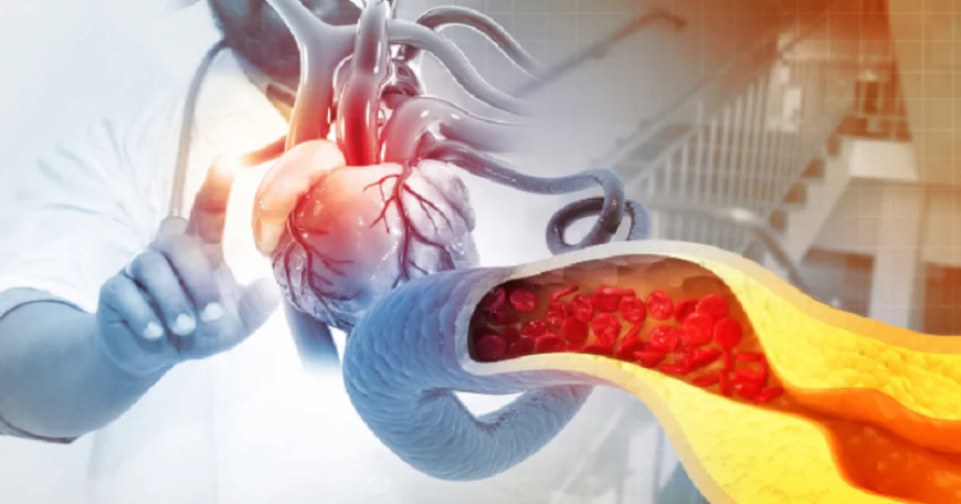 कोलेस्ट्रॉल की नई गाइडलाइन जारी, जानें कितना होना चाहिए नॉर्मल लेवल, किस उम्र में कराएं जांच