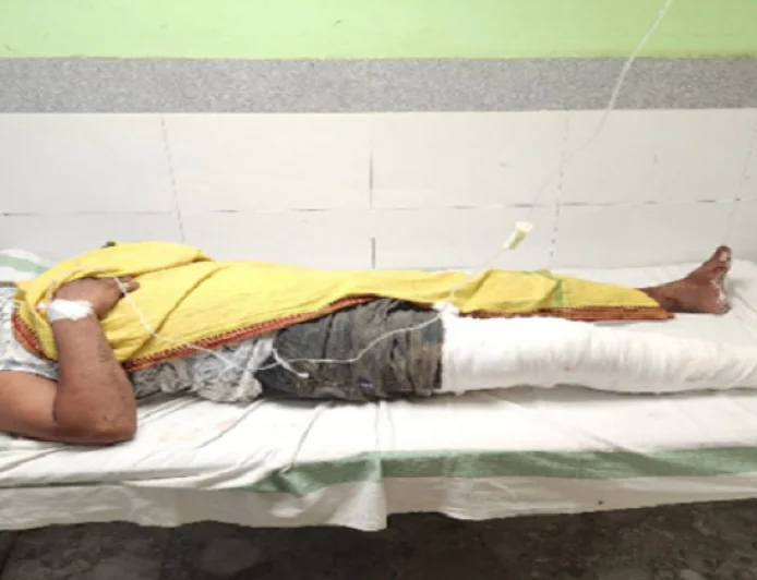 बंटी यादव हत्याकांड का मुख्य आरोपी रवीश उर्फ बसिया पुलिस मुठभेड़ में जख्मी, देसी कट्टा बरामद