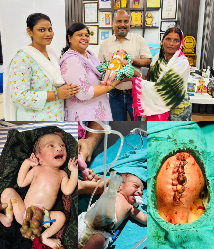 प्रकाश मल्टीस्पेशियलिटी हॉस्पिटल में दो चरणों की जटिल सर्जरी से नवजात को मिला नया जीवन, जन्म के समय पेट के बाहर थी पूरी आंत