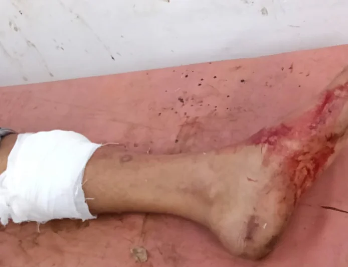 वैशाली में लाइन होटल पर ताबड़तोड़ फायरिंग, ग्राहक को लगी गोली; संचालक के अपहरण का भी आरोप
