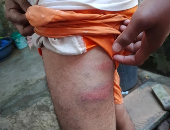 पालीगंज में पुलिस ओपी पर अवैध वसूली और पिटाई का आरोप, गांजा के साथ पकड़े युवक ने लगाए गंभीर आरोप