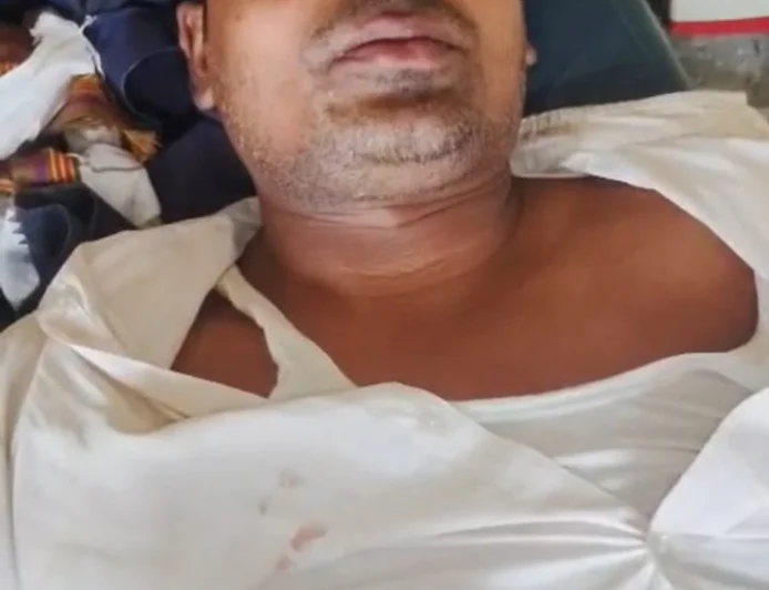 औरंगाबाद में CSP संचालक को गोली मारकर 3 लाख की लूट, ओवरटेक कर अपराधियों ने दिया वारदात को अंजाम
