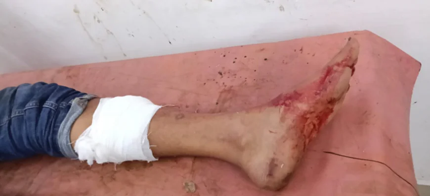 वैशाली में लाइन होटल पर ताबड़तोड़ फायरिंग, ग्राहक को लगी गोली; संचालक के अपहरण का भी आरोप