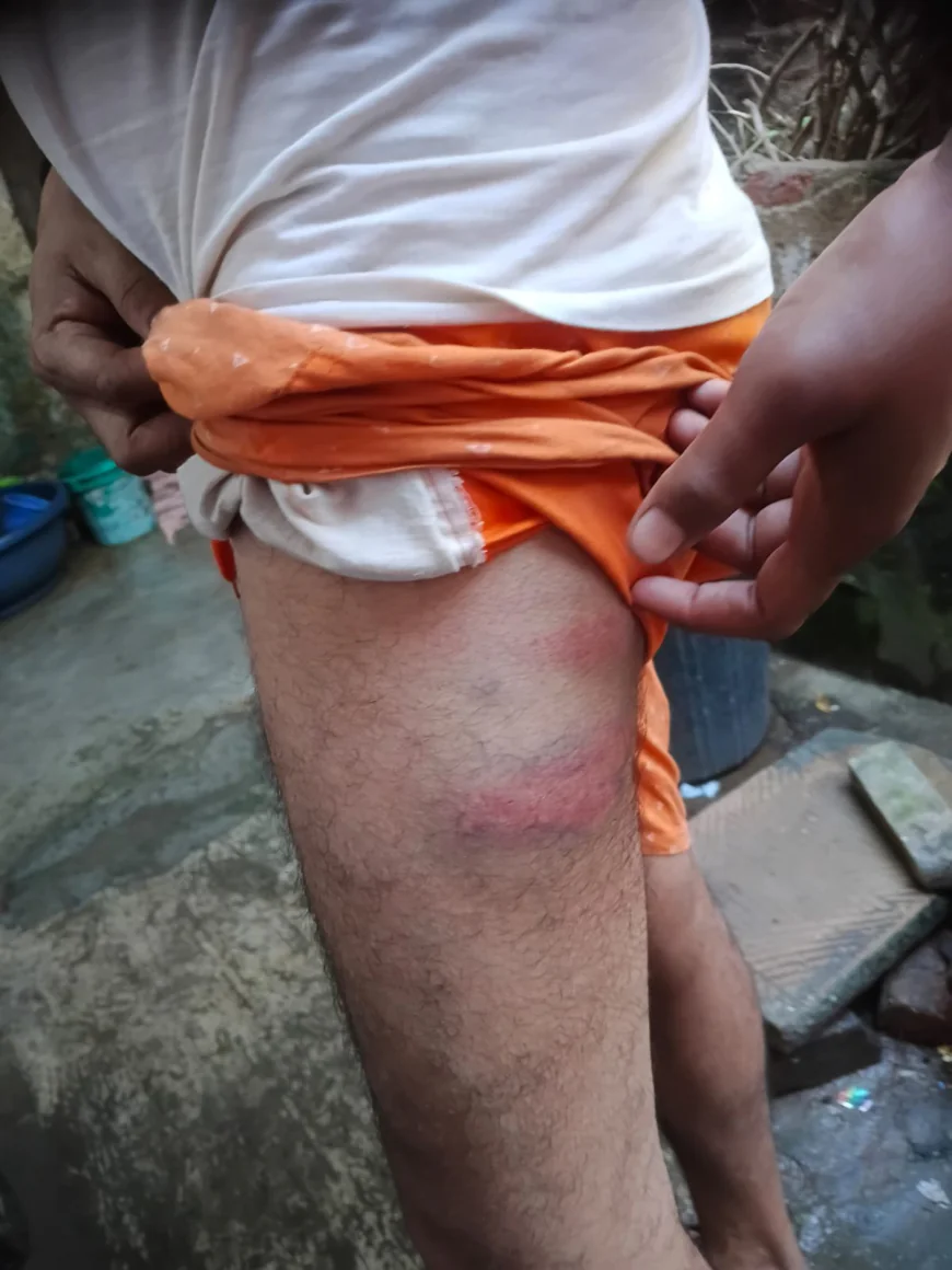 पालीगंज में पुलिस ओपी पर अवैध वसूली और पिटाई का आरोप, गांजा के साथ पकड़े युवक ने लगाए गंभीर आरोप