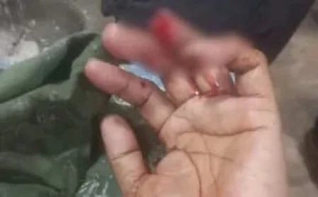 बगहा में मां दुर्गा की डोली शोभायात्रा में पागल कुत्ते का आतंक, 50 से अधिक लोगों को काटा; 5 गंभीर घायल