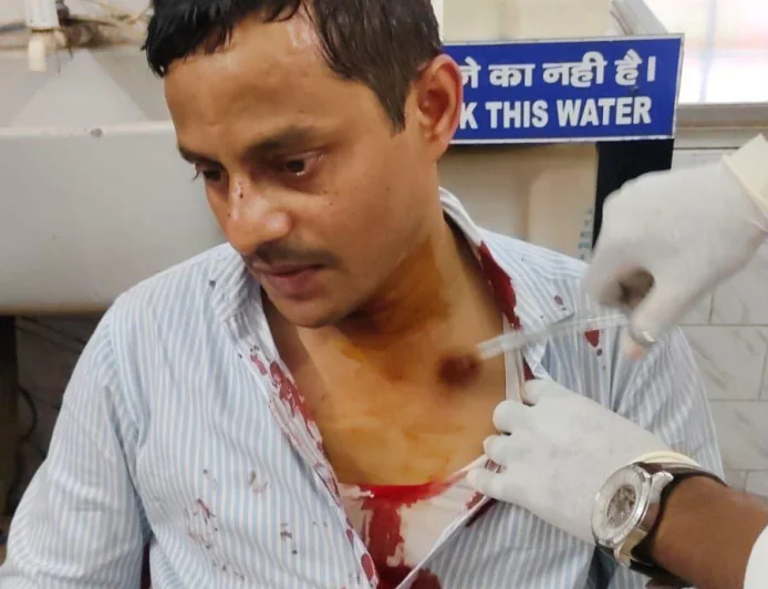 पटना में STF इंस्पेक्टर पर हेलमेट से हमला, सिर फटा; BJP नेता हिरासत में